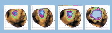 PiCUS-3彈性波樹(shù)木斷層畫(huà)像診斷儀