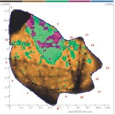 TMS 3樹木穩(wěn)定安全性測試儀